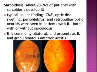 Sarcoidosis: About 23-26% of patients with
sarcoidosis develop IU
 typical ocular findings-CME, optic disc
swelling, periphlebitis, and retrobulbar optic
neuritis were seen in patients with IU, both
with or without sarcoidosis
 It is commonly bilateral, and presents as IU
and granulomatous anterior uveitis
 