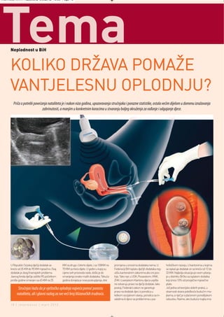 Intermeco MART1:Layout 2 3.3.2012 13:55 Page 18




Tema  Neplodnost u BiH



      KOLIKO DRŽAVA POMAŽE
      VANTJELESNU OPLODNJU?
        Priča o potrebi povećanja nataliteta je i nakon niza godina, upozoravanja stručnjaka i porazne statistike, ostala većim dijelom u domenu izražavanja
                              zabrinutosti, a manjim u konkretnim koracima u stvaranju boljeg okruženja za rađanje i odgajanje djece.




      U Republici Srpskoj dječiji dodatak se     KM za drugo i četvrto dijete, i sa 100KM na   promjena u iznosima dodataka nema. U           hofizičkom razvoju. U kantonima u kojima
      kreće od 35 KM do 90 KM mjesečno. Ovaj     70 KM za treće dijete. U godini u kojoj su    Federaciji BiH isplatu dječijh dodataka reg-   se isplaćuje dodatak on se kreće od 12 do
      dodatak je zbog finansijskih problema      cijene svih proizvoda rasle, došlo je do      ulišu kantonalnim zakonima ako oni pos-        33 KM. Najbolja situacija po ovom pitanju
      Javnog fonda dječije zaštite RS početkom   smanjenja ionako malih dodataka. Tekuća       toje. Tako npr. u USK, Posavskom, HNK,         je u distriktu Brčko sa isplatom dodatka
      prošle godine smanjen sa 45 KM na 35       godina donijela je nova poskupljenja, dok     ZHK i Livanjskom Kantonu djeca uopšte          koji iznosi 10% od prosječne mjesečne
                                                                                               ne ostvaruju pravo na dječiji dodatak. Iako    plate.
            Stručnjaci kažu da je vještačka oplodnja najveća pomoć porastu                     postoji, Federalni zakon ne garantuje          Još jedna od teorijsko dobrih praksi, u
                                                                                               pravo na dodatak djeci iz porodica u           stvarnosti stvara poteškoće budućim ma-
           nataliteta, ali i glavni razlog za sve veći broj blizanačkih trudnoća.              teškom socijalnom stanju, porodica sa in-      jkama, a riječ je o plaćenom porodiljskom
                                                                                               validima ili djece sa problemima u psi-        odsustvu. Naime, ako buduća majka ima
      18 | intermezzo | mart 2012.
 