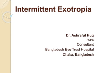 Intermittent Exotropia
Dr. Ashraful Huq
FCPS
Consultant
Bangladesh Eye Trust Hospital
Dhaka, Bangladesh
 