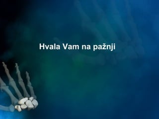 Hvala Vam na pažnji
 