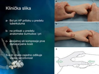 Klinička slika
a- Bol pri AP pritisku u predelu
tuberkuluma
b- na pritisak u predelu
anatomske burmutice i pri
c- aksijalnoj sili kompresije prve
metakarpalne kosti
Sva tri znaka zajedno odlikuje
visoka senzitivnost
c
 
