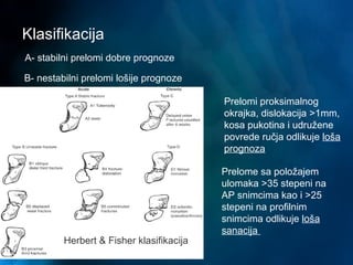 Klasifikacija
Herbert & Fisher klasifikacija
A- stabilni prelomi dobre prognoze
B- nestabilni prelomi lošije prognoze
Prelomi proksimalnog
okrajka, dislokacija >1mm,
kosa pukotina i udružene
povrede ručja odlikuje loša
prognoza
Prelome sa položajem
ulomaka >35 stepeni na
AP snimcima kao i >25
stepeni na profilnim
snimcima odlikuje loša
sanacija
 