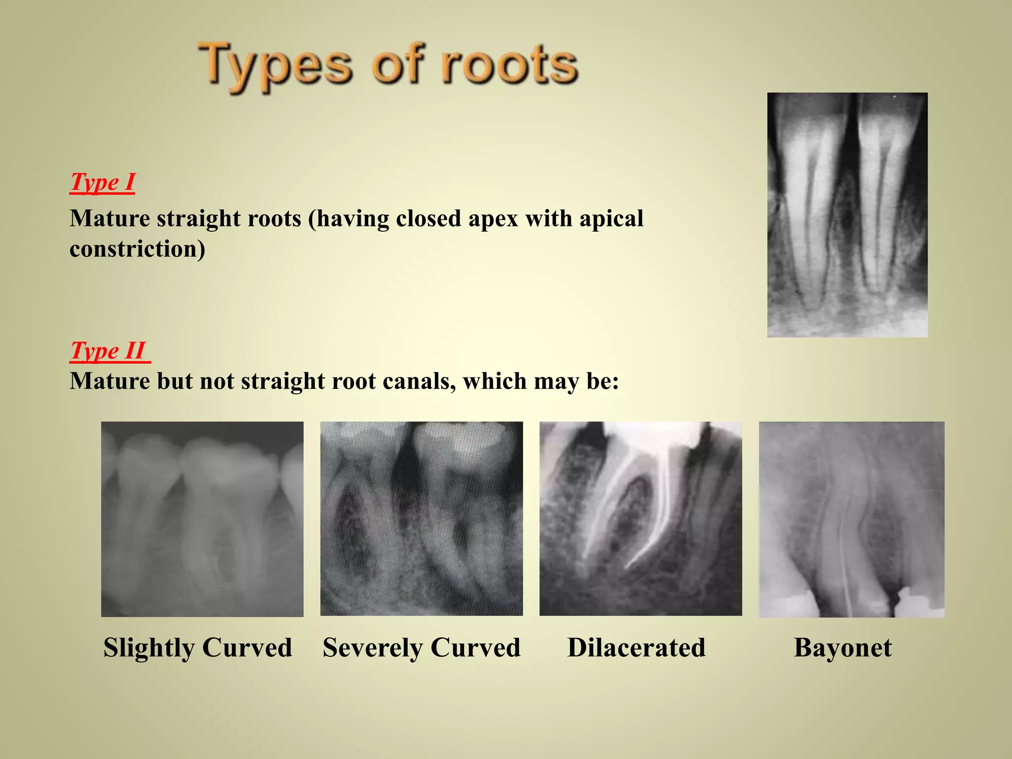 Internal anatomy of tooth | PPTX