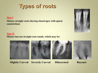 Internal anatomy of tooth | PPTX