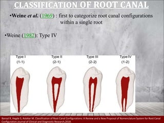 Weine Classification Internal anatomy of pulp space | PPT