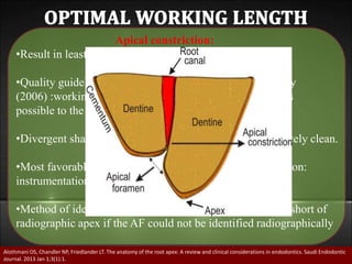 Internal anatomy of pulp space | PPT