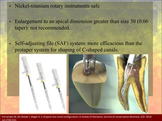 Pulp Space Injection Internal anatomy of pulp space | PPT