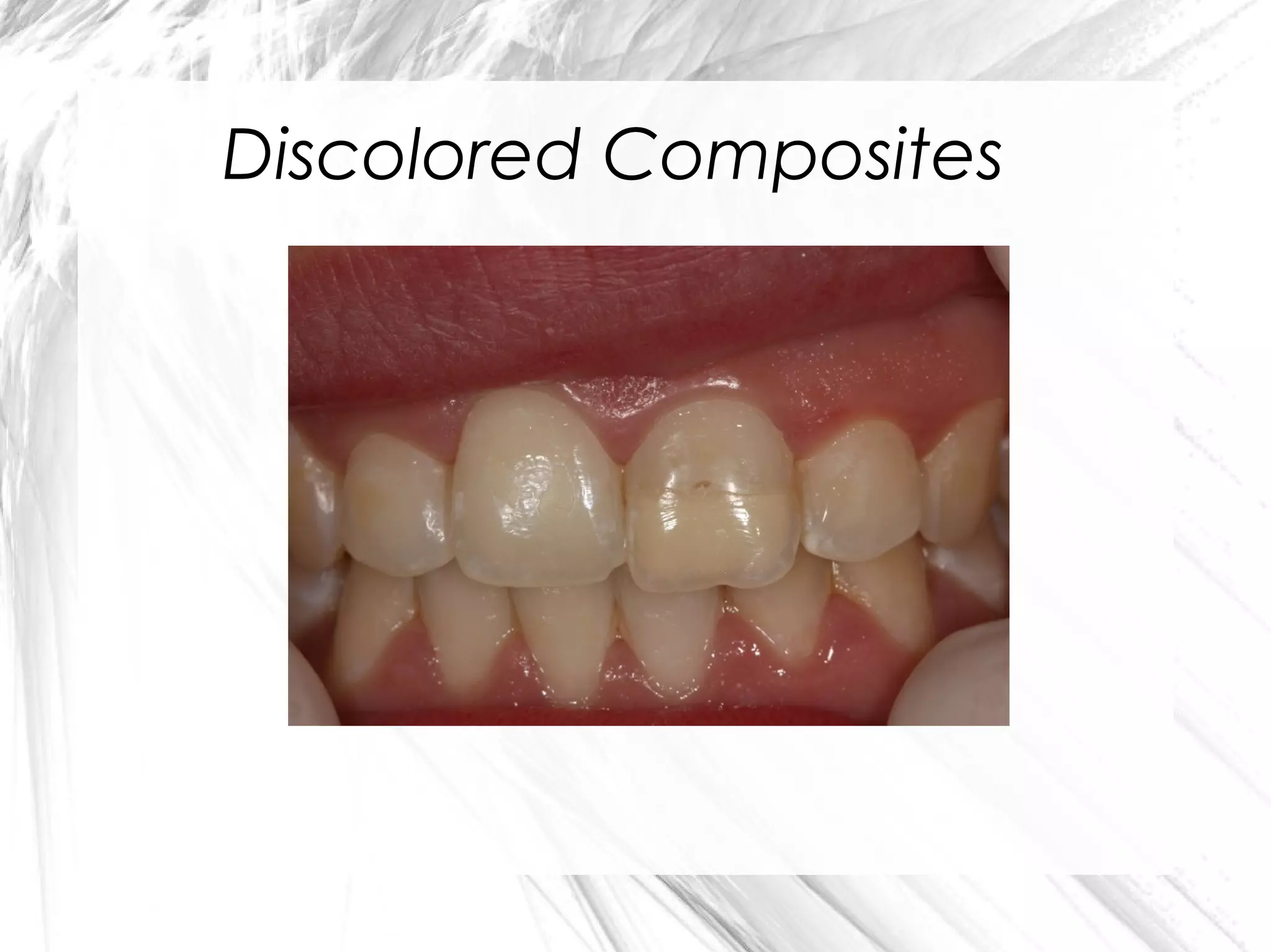 Discolored Composites

 