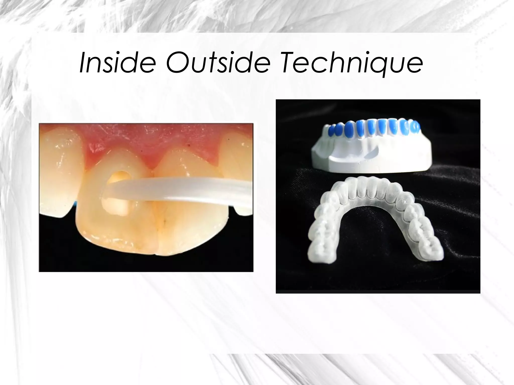 Inside Outside Technique

 