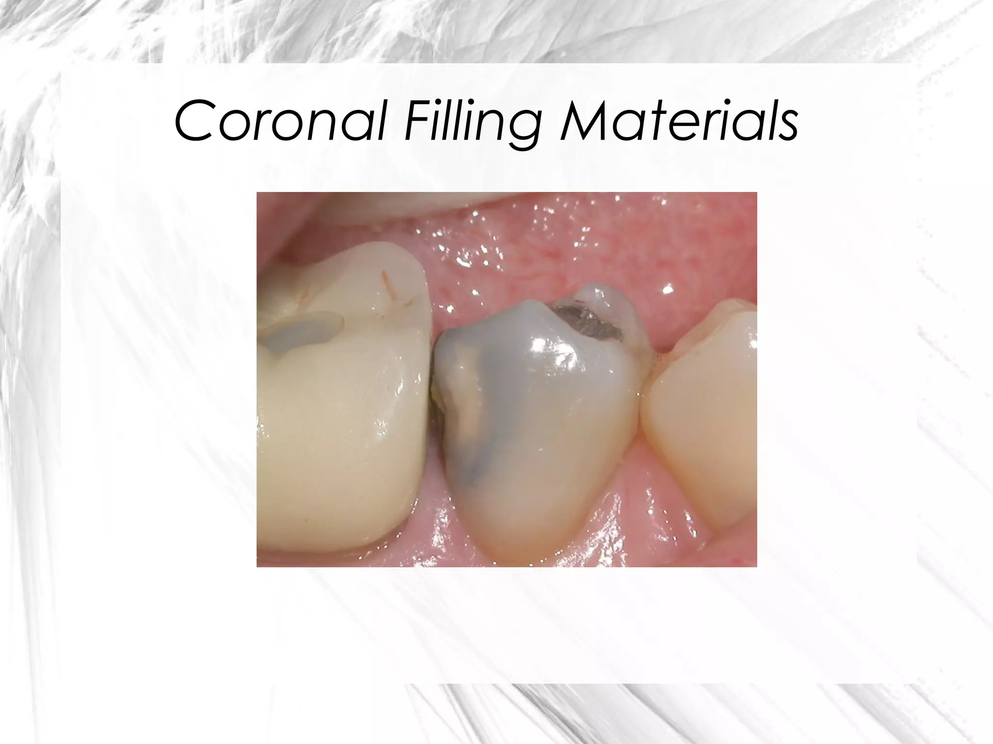 Coronal Filling Materials

 