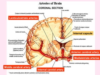 Internal capsule
Lenticulostriate arteries
Middle cerebral artery
Internal carotid artery
Anterior cerebral artery
Medialstriate arteries
CORONAL SECTION
 
