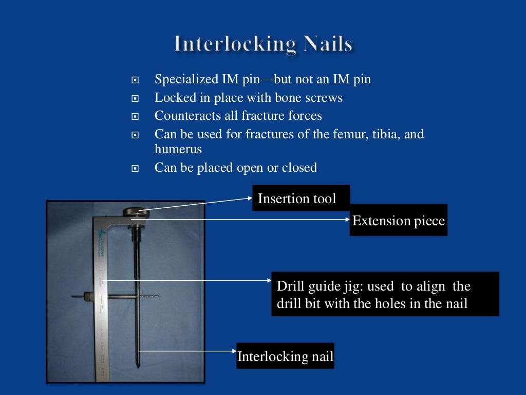 Internal fixation techniques