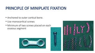 INTERNAL FIXATION IN MAXILLOFACIAL TRAUMA- PART A [Autosaved].pptx