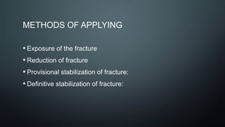 METHODS OF APPLYING
• Exposure of the fracture
• Reduction of fracture
• Provisional stabilization of fracture:
• Definitive stabilization of fracture:
 