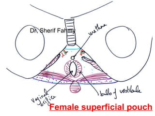 Female superficial pouch
Dr. Sherif Fahmy
 