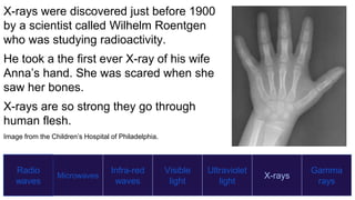 Radio
waves
Microwaves
Infra-red
waves
Visible
light
Ultraviolet
light
X-rays
Gamma
rays
X-rays were discovered just before 1900
by a scientist called Wilhelm Roentgen
who was studying radioactivity.
He took a the first ever X-ray of his wife
Anna’s hand. She was scared when she
saw her bones.
X-rays are so strong they go through
human flesh.
Image from the Children’s Hospital of Philadelphia.
 