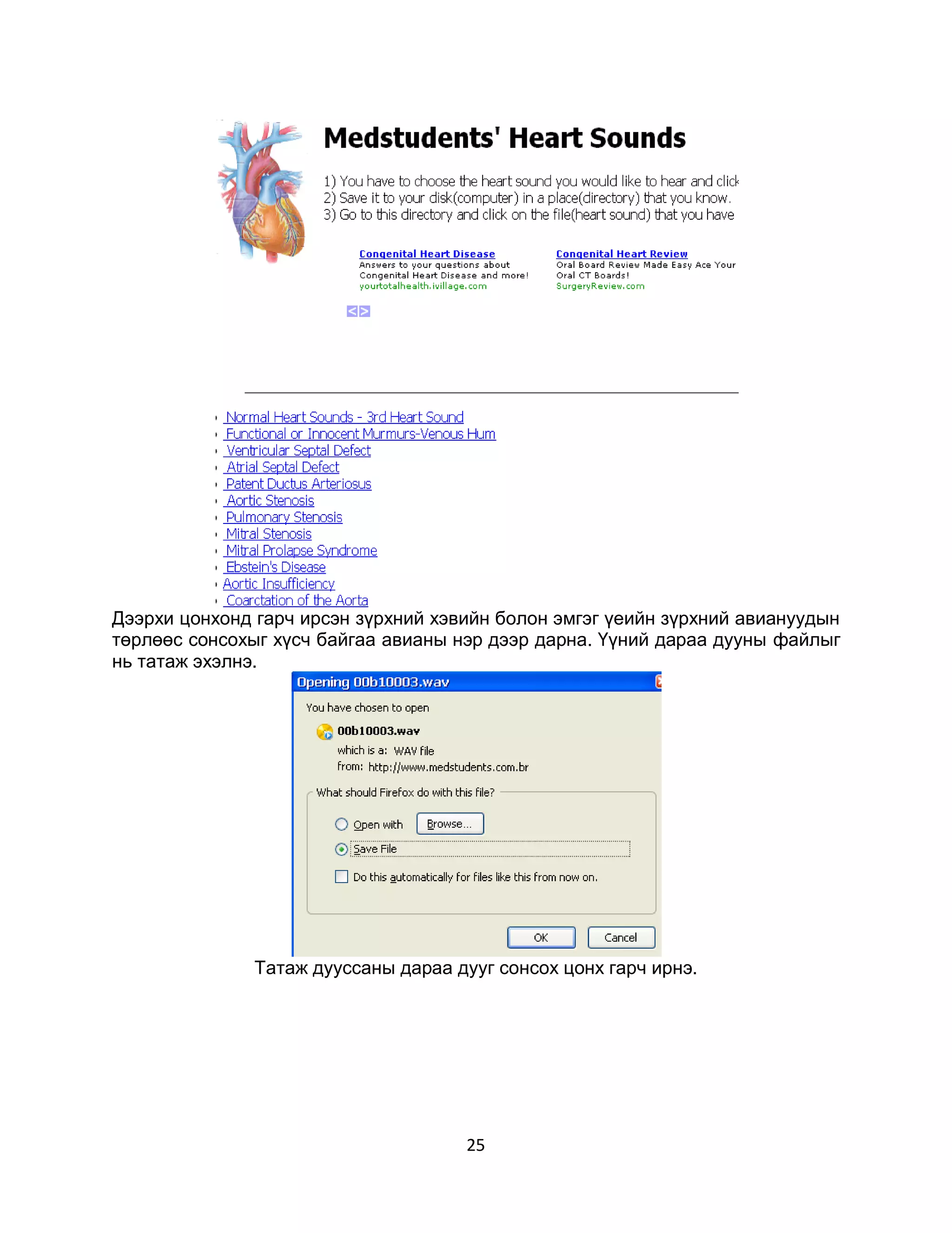 Дээрхи цонхонд гарч ирсэн зүрхний хэвийн болон эмгэг үеийн зүрхний авиануудын
төрлөөс сонсохыг хүсч байгаа авианы нэр дээр дарна. Үүний дараа дууны файлыг
нь татаж эхэлнэ.




               Татаж дууссаны дараа дууг сонсох цонх гарч ирнэ.




                                     25
 