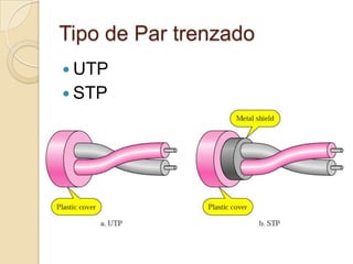 Tipo de Par trenzado
 UTP
 STP
 