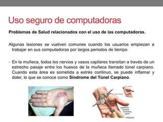 Uso seguro de computadoras
Problemas de Salud relacionados con el uso de las computadoras.
Algunas lesiones se vuelven comunes cuando los usuarios empiezan a
trabajar en sus computadoras por largos periodos de tiempo
• En la muñeca, todos los nervios y vasos capilares transitan a través de un
estrecho pasaje entre los huesos de la muñeca llamado túnel carpiano.
Cuando esta área es sometida a estrés continuo, se puede inflamar y
doler, lo que se conoce como Síndrome del Túnel Carpiano.
 