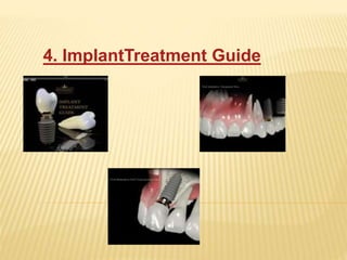 4. ImplantTreatment Guide
 