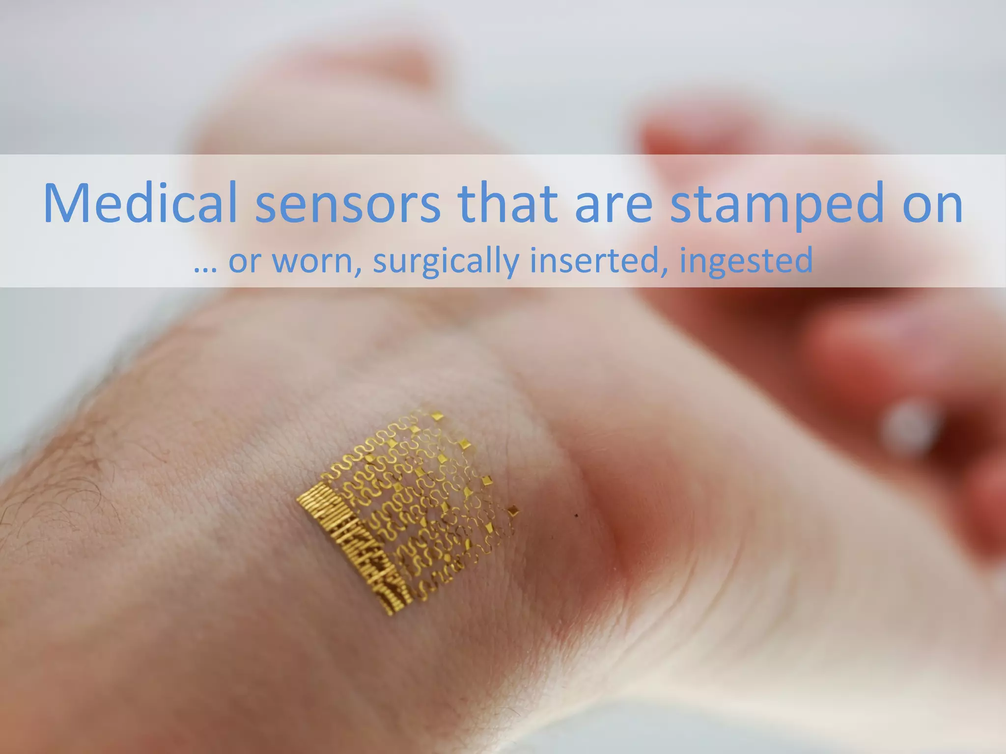 Medical	
  sensors	
  that	
  are	
  stamped	
  on	
  
…	
  or	
  worn,	
  surgically	
  inserted,	
  ingested	
  	
  
 