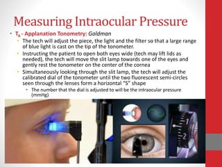 Measuring Intraocular Pressure
• TA - Applanation Tonometry: Goldman
• The tech will adjust the piece, the light and the filter so that a large range
of blue light is cast on the tip of the tonometer.
• Instructing the patient to open both eyes wide (tech may lift lids as
needed), the tech will move the slit lamp towards one of the eyes and
gently rest the tonometer on the center of the cornea
• Simultaneously looking through the slit lamp, the tech will adjust the
calibrated dial of the tonometer until the two fluorescent semi-circles
seen through the lenses form a horizontal “S” shape
• The number that the dial is adjusted to will be the intraocular pressure
(mmHg)
 