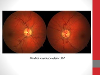 Standard images printed from SDP
 