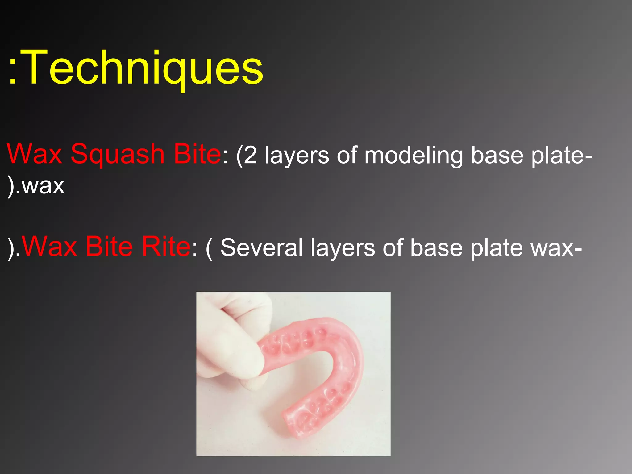 Interocclusal record PPT