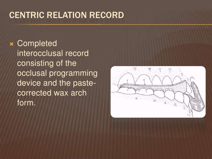 dr vafaee shlinberg interocclusal records