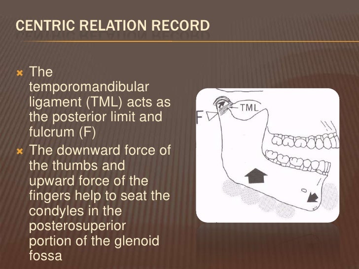 dr vafaee shlinberg interocclusal records