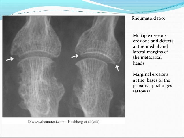 Joint X-Ray