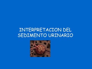 INTERPRETACION DEL
SEDIMENTO URINARIO
 