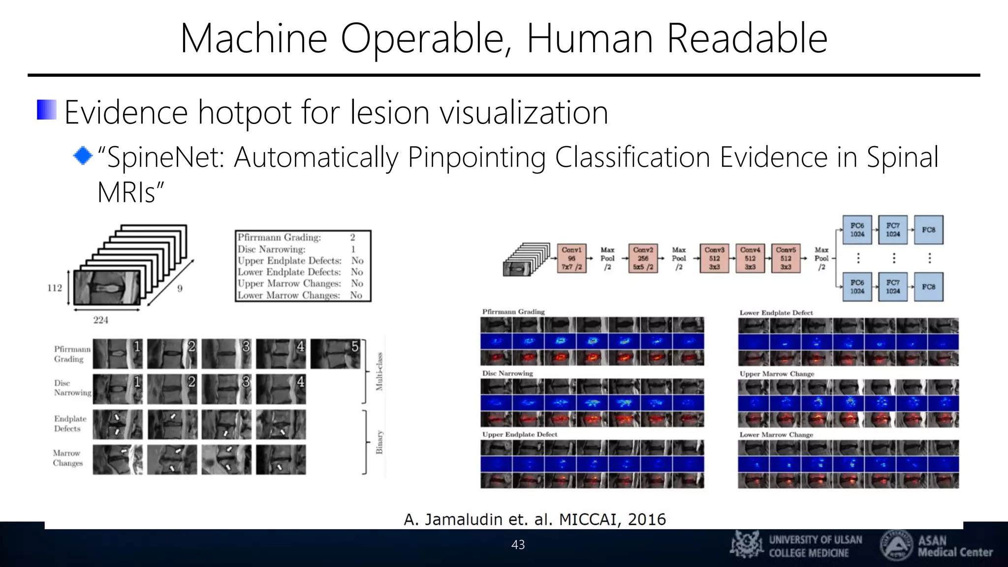 Machine Operable, Human Readable
Evidence hotpot for lesion visualization
“SpineNet: Automatically Pinpointing Classification Evidence in Spinal
MRIs”
43
 