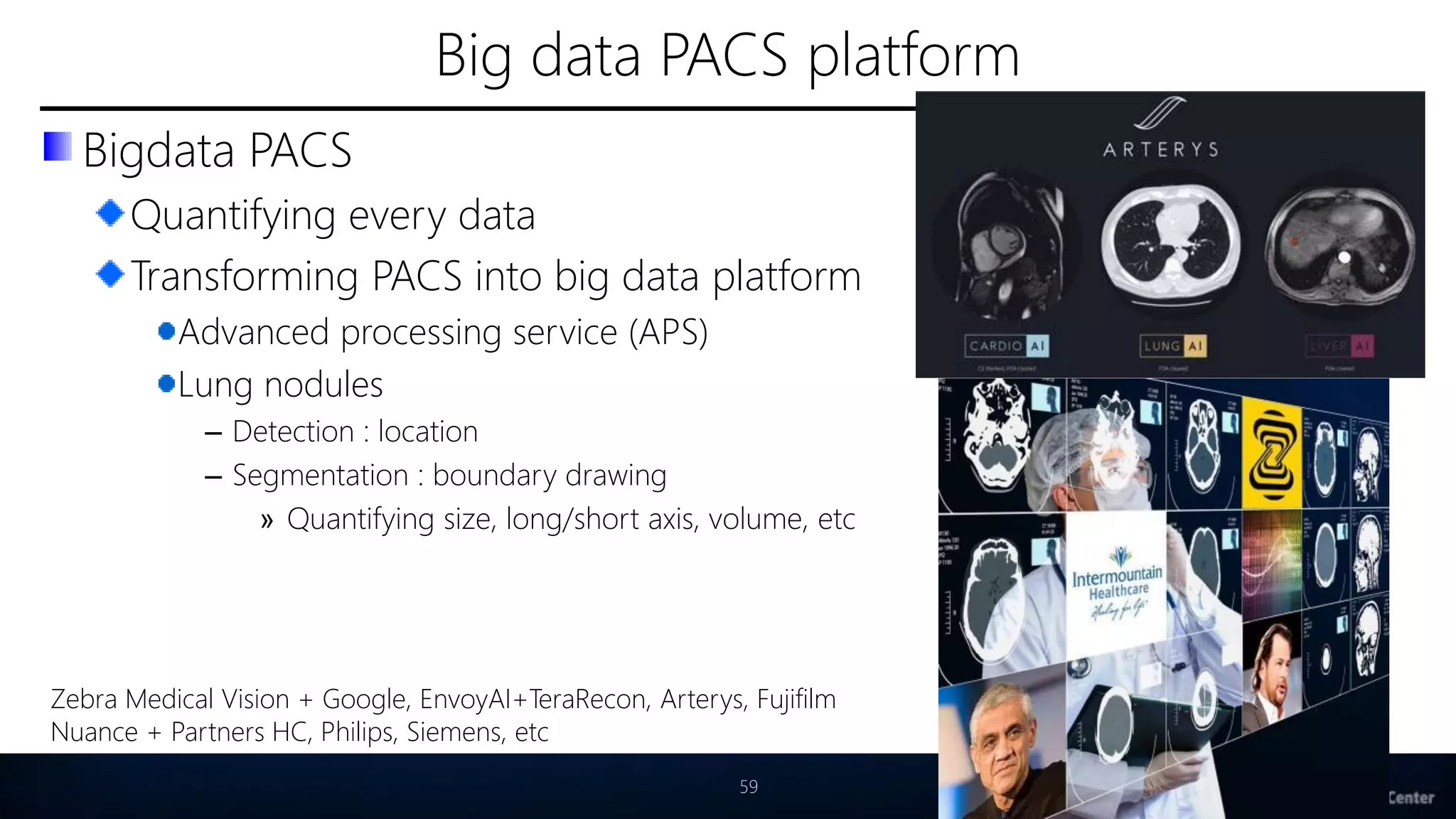 Big data PACS platform
Bigdata PACS
Quantifying every data
Transforming PACS into big data platform
Advanced processing service (APS)
Lung nodules
– Detection : location
– Segmentation : boundary drawing
» Quantifying size, long/short axis, volume, etc
59
Zebra Medical Vision + Google, EnvoyAI+TeraRecon, Arterys, Fujifilm
Nuance + Partners HC, Philips, Siemens, etc
 