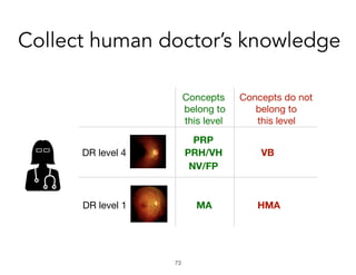 Collect human doctor’s knowledge
!73
PRP
PRH/VH
NV/FP
VB
MA HMA
DR level 4
DR level 1
Concepts

belong to 

this level
Con...