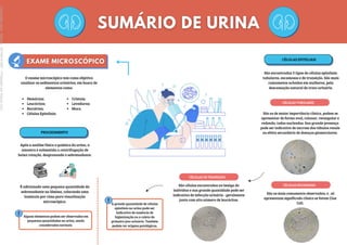 O exame microscópico tem como objetivo
analisar os sedimentos urinários, em busca de
elementos como:
Hemácias;
Leucócitos;
Bactérias;
Células Epiteliais;
Cristais;
Leveduras;
Muco.
PROCEDIMENTO
Após a análise física e química da urina, a
amostra é submetida a centrifugação de
baixa rotação, desprezando o sobrenadante.
É adicionado uma pequena quantidade do
sobrenadante na lâmina, colocando uma
lamínula por cima para visualização
microscópica.
Alguns elementos podem ser observados em
pequenas quantidades na urina, sendo
considerados normais.
CÉLULAS EPITELIAIS
São encontradas 3 tipos de células epiteliais:
tubulares, escamosas e de transição. São mais
comumente achados em mulheres, pela
descamação natural do trato urinário.
São as de maior importância clínica, podem se
apresentar de forma oval, colunar, retangular e
redonda, todas nucleadas. Sua grande presença
pode ser indicativo de necrose dos túbulos renais
ou efeito secundário de doenças glomerulares.
CÉLULAS TUBULARES
São as mais comumente observadas, e , só
apresentam significado clínico se forem Clue
Cell.
CÉLULAS ESCAMOSAS
São células encontradas na bexiga do
indivíduo e sua grande quantidade pode ser
indicativo de infecção urinária - geralmente
junto com alto número de leucócitos.
CÉLULAS DE TRANSIÇÃO
A grande quantidade de células
epiteliais na urina pode ser
indicativo de ausência de
higienização ou a coleta do
primeiro jato urinário. Também
podem ter origens patológicas.
Licenciado
para
-
Marcia
-
45148147687
-
Protegido
por
Eduzz.com
 