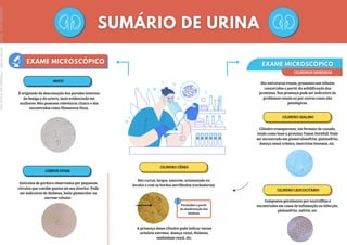 Formados a partir
da desidratação dos
hialinos.
MUCO
É originado da descamação das paredes internas
da bexiga e da uretra, mais evidenciado em
mulheres. Não possuem relevância clínica e são
encontrados como filamentos finos.
CORPOS OVAIS
Gotículas de gordura observadas por pequenos
círculos que contêm pontos em seu interior. Pode
ser indicativo de diabetes, lesão glomerular ou
necrose tubular.
CILINDROS URINÁRIOS
São estruturas renais, presentes nos túbulos
contorcidos a partir da solidificação das
proteínas. Sua presença pode ser indicativo de
problemas renais ou por outros casos não
patológicos.
CILINDRO HIALINO
Cilindro transparente, em formato de canudo,
tendo como base a proteína Tamm Horefall. Pode
ser encontrado em glomerulonefrite, pielonefrite,
doença renal crônica, exercícios intensos, etc.
CILINDRO CÉREO
São curtos, largos, amarelo, acinzentado ou
incolor e com as bordas serrilhadas (rachaduras).
A presença desse cilindro pode indicar estase
urinária extrema, doença renal, diabetes,
amiloidose renal, etc.
CILINDRO LEUCOCITÁRIO
Compostos geralmente por neutrófilos e
encontrados em casos de inflamação ou infecção,
pielonefrite, nefrite, etc.
Licenciado
para
-
Marcia
-
45148147687
-
Protegido
por
Eduzz.com
 