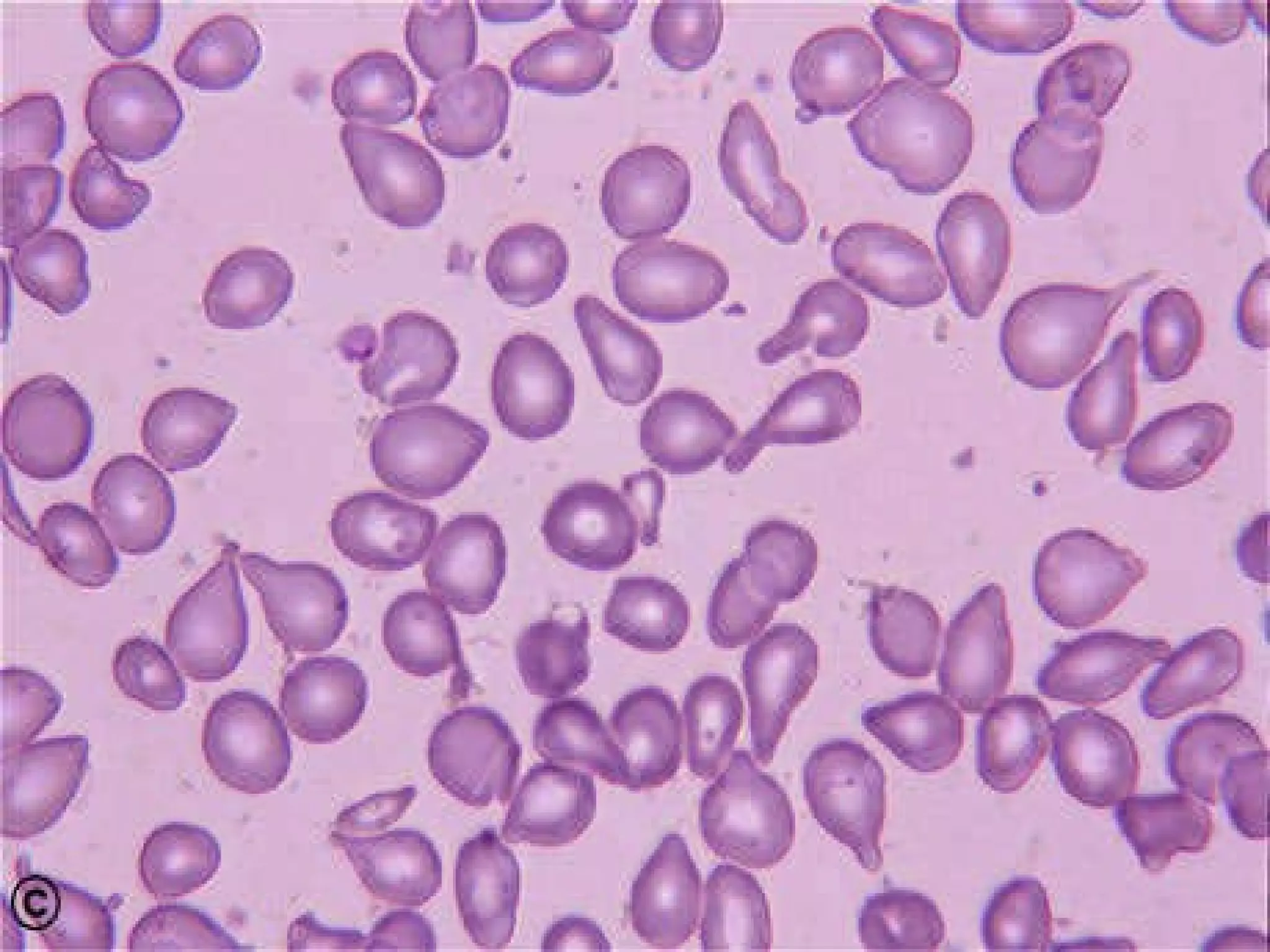 interpretaci-n-cl-nica-de-la-bhc-ppt