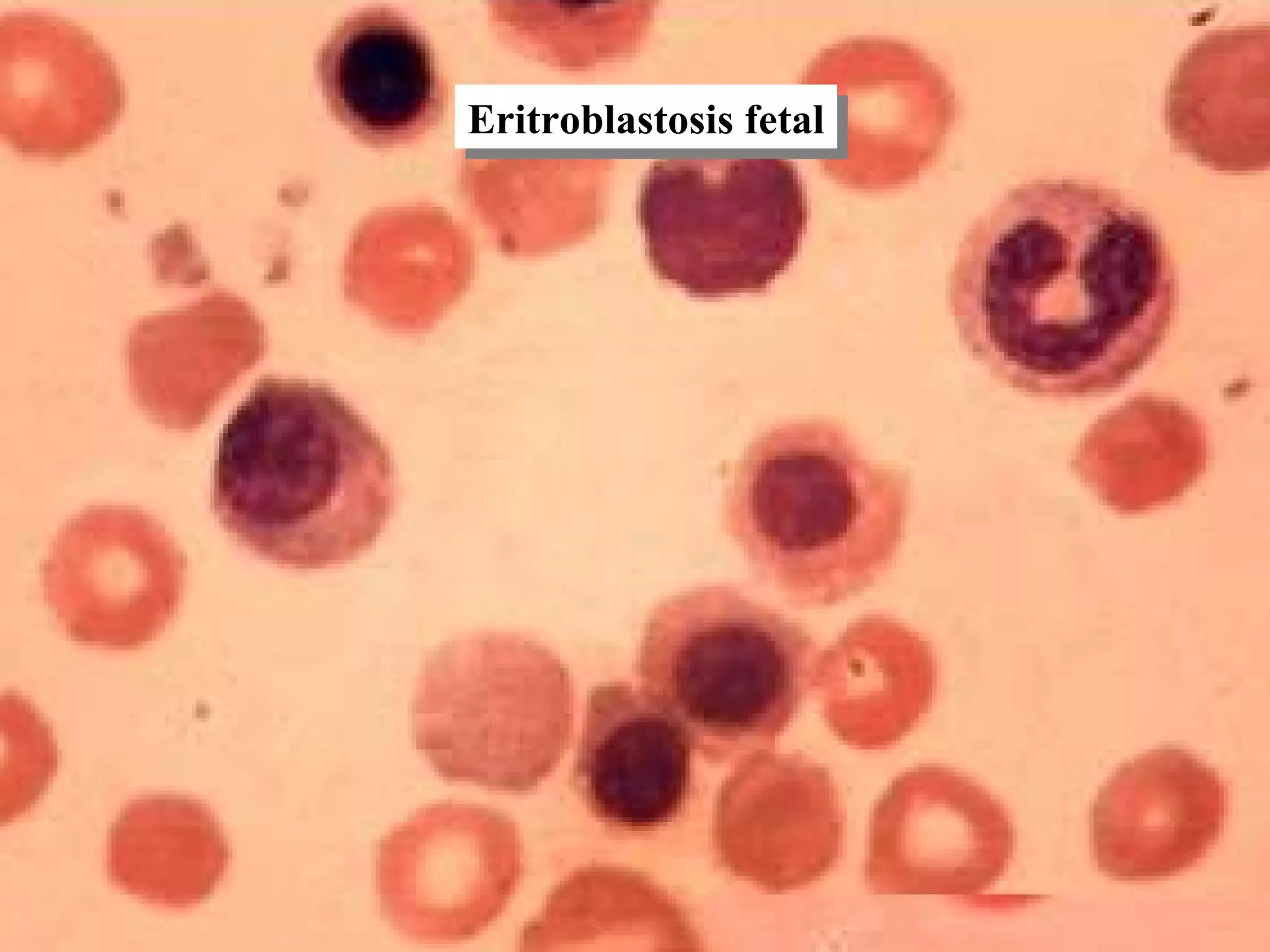 interpretaci-n-cl-nica-de-la-bhc-ppt