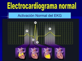 Activación Normal del EKG
 