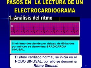 17
El ritmo cardiaco normal, se inicia en el
NODO SINUSAL; por ello se denomina
Ritmo Sinusal.
 