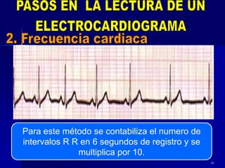 21
Para este método se contabiliza el numero de
intervalos R R en 6 segundos de registro y se
multiplica por 10.
 