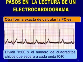 22
Otra forma exacta de calcular la FC es:
Dividir 1500 x el numero de cuadraditos
chicos que separa a cada onda R-R
 