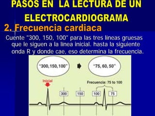 Cuente "300, 150, 100" para las tres lCuente "300, 150, 100" para las tres lííneas gruesasneas gruesas
que le siguen a la lque le siguen a la líínea inicial. hasta la siguientenea inicial. hasta la siguiente
onda R y donde cae, eso determina la frecuenciaonda R y donde cae, eso determina la frecuencia..
 