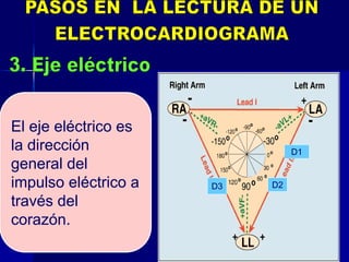 25
El eje eléctrico es
la dirección
general del
impulso eléctrico a
través del
corazón.
D1
D2D3
 
