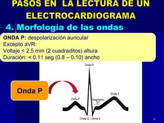 ONDA P: despolarización auricular
Excepto aVR
Voltaje < 2.5 mm (2 cuadraditos) altura
Duración: < 0.11 seg (0.8 – 0.10) ancho
27
Onda P
 