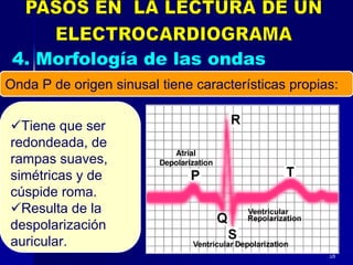28
Onda P de origen sinusal tiene características propias:
Tiene que ser
redondeada, de
rampas suaves,
simétricas y de
cúspide roma.
Resulta de la
despolarización
auricular.
 