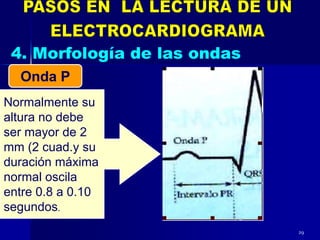 29
Normalmente su
altura no debe
ser mayor de 2
mm (2 cuad.y su
duración máxima
normal oscila
entre 0.8 a 0.10
segundos.
Onda P
 