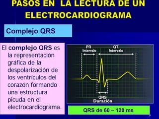 32
El complejo QRS es
la representación
gráfica de la
despolarización de
los ventrículos del
corazón formando
una estructura
picuda en el
electrocardiograma.
Complejo QRS
QRS de 60 – 120 ms
 