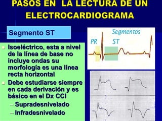  IsoelIsoelééctricoctrico,, esta a nivelesta a nivel
de la lde la líínea de basenea de base nono
incluye ondasincluye ondas susu
morfologmorfologíía es una la es una lííneanea
recta horizontalrecta horizontal
 Debe estudiarse siempreDebe estudiarse siempre
en cada derivacien cada derivacióón y esn y es
bbáásico en elsico en el DxDx CCICCI
–– SupradesniveladoSupradesnivelado
–– InfradesniveladoInfradesnivelado
Segmento ST
 